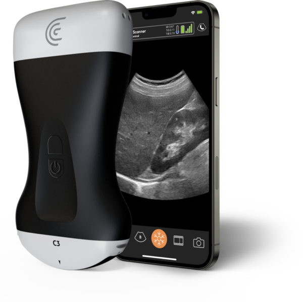 C3-Convex-Handheld-Portable-Wireless-Ultrasound-Scanner