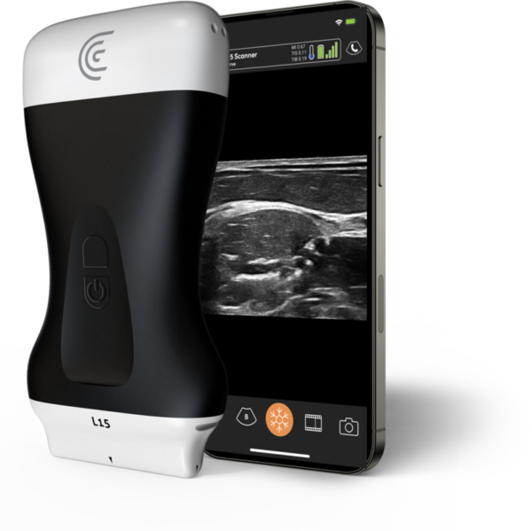 L15-High-Freq-Linear-Handheld-Portable-Wireless-Ultrasound-Scanner