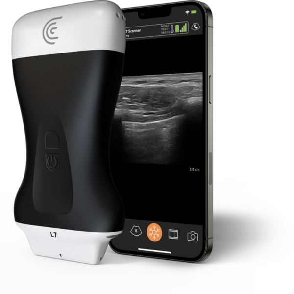 L7-Linear-Handheld-Portable-Wireless-Ultrasound-Scanner