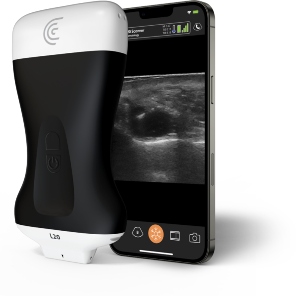 L20-Ultra-High-Freq-Linear-Handheld-Portable-Wireless-Ultrasound-Scanner
