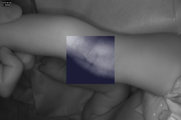 Detector de vene Vein Probe - imagine 13