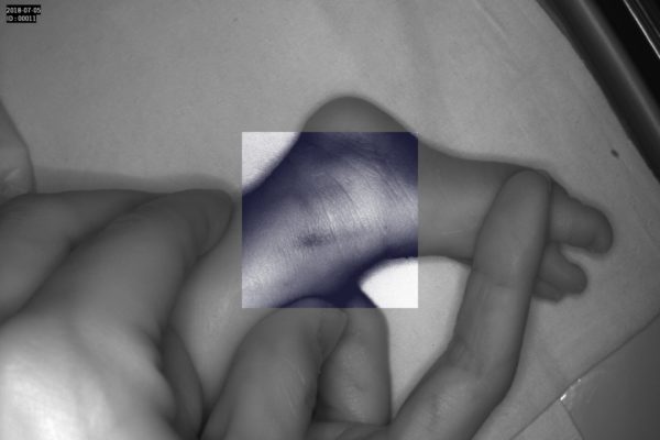 Detector de vene Vein Probe - imagine 17