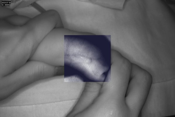 Detector de vene Vein Probe - imagine 20