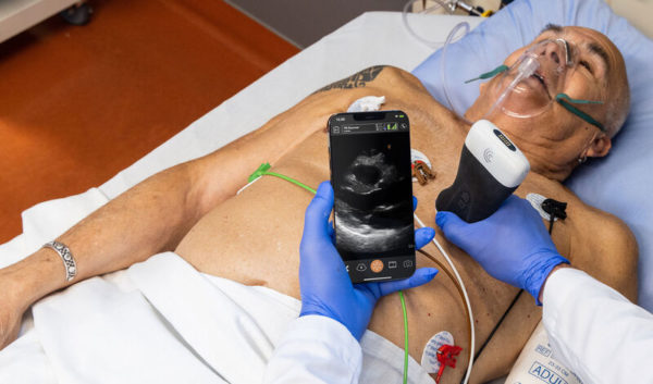 Cardiac-Wireless-Portable-Handheld-Ultrasound-Clarius