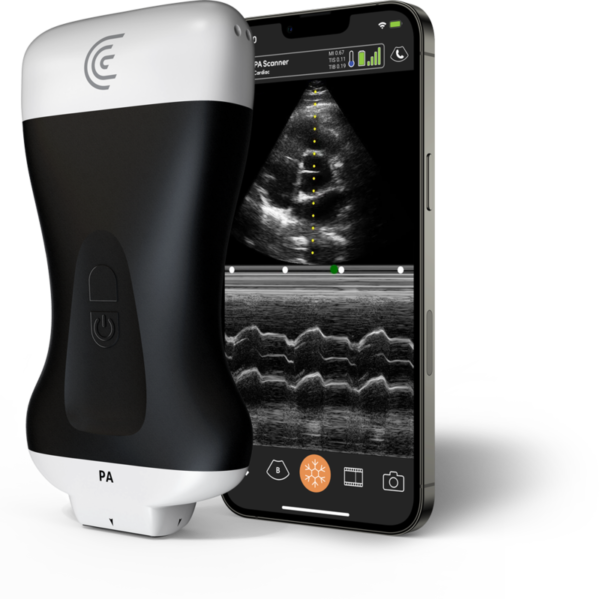 PA-Phased-Array-Handheld-Portable-Wireless-Ultrasound-Scanner